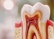 endodontic treatment in Raleigh North Raleigh endodontics