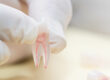 root canal near me