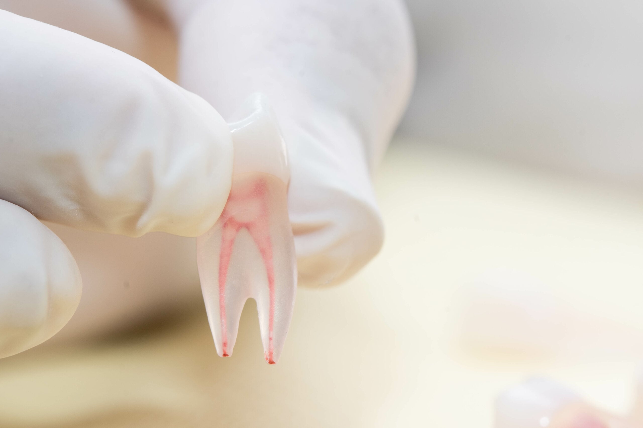 root canal near me